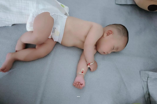 滨州宝宝脸上有白色斑块